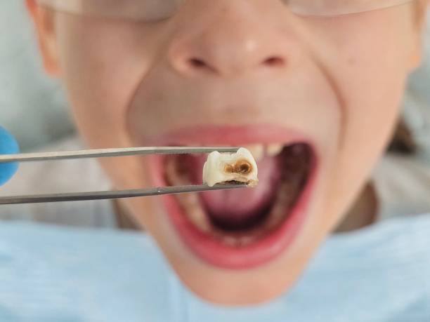 Best Urgent Tooth Repair  in Raymond, IL